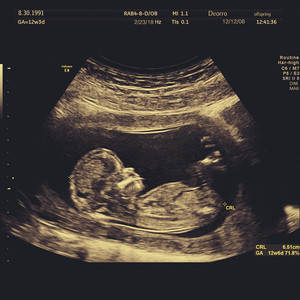 中国老头老妇七ube
